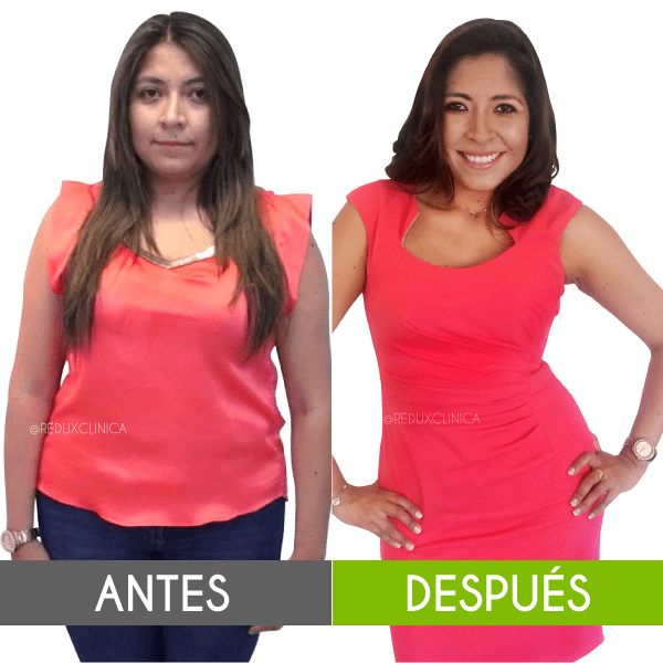 NUEVO! PACK MALLA ADELGAZANTE – Redux Clinica